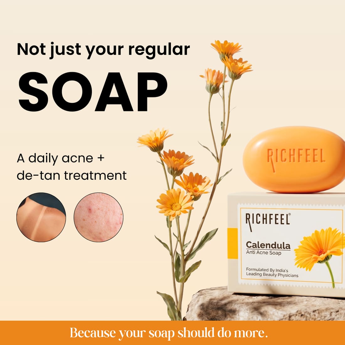 Richfeel Canendula Anti Acne Soap - Image 2